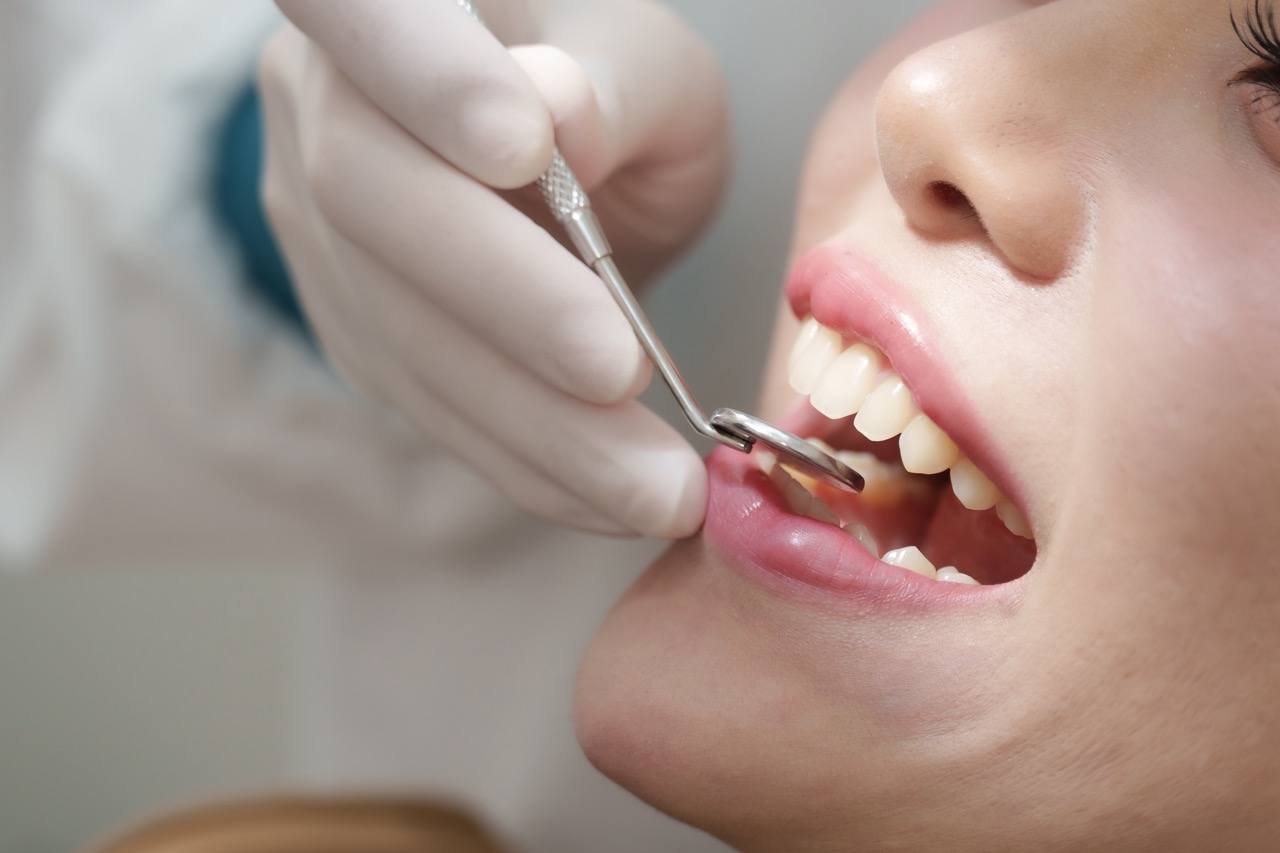 Macro shot of dentist using sickle scaler and mouth mirror inspecting teeth of female Asian patient during dental checkup session for plaque evaluation and oral cleaning assessment.